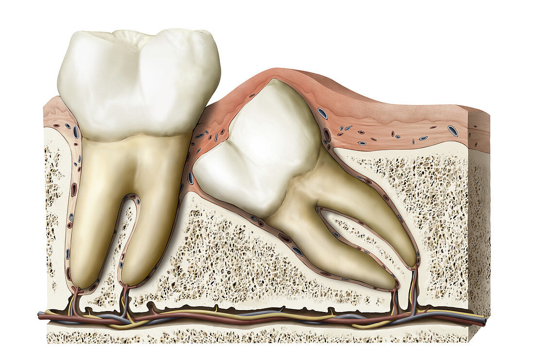 Wisdom teeth, illustration