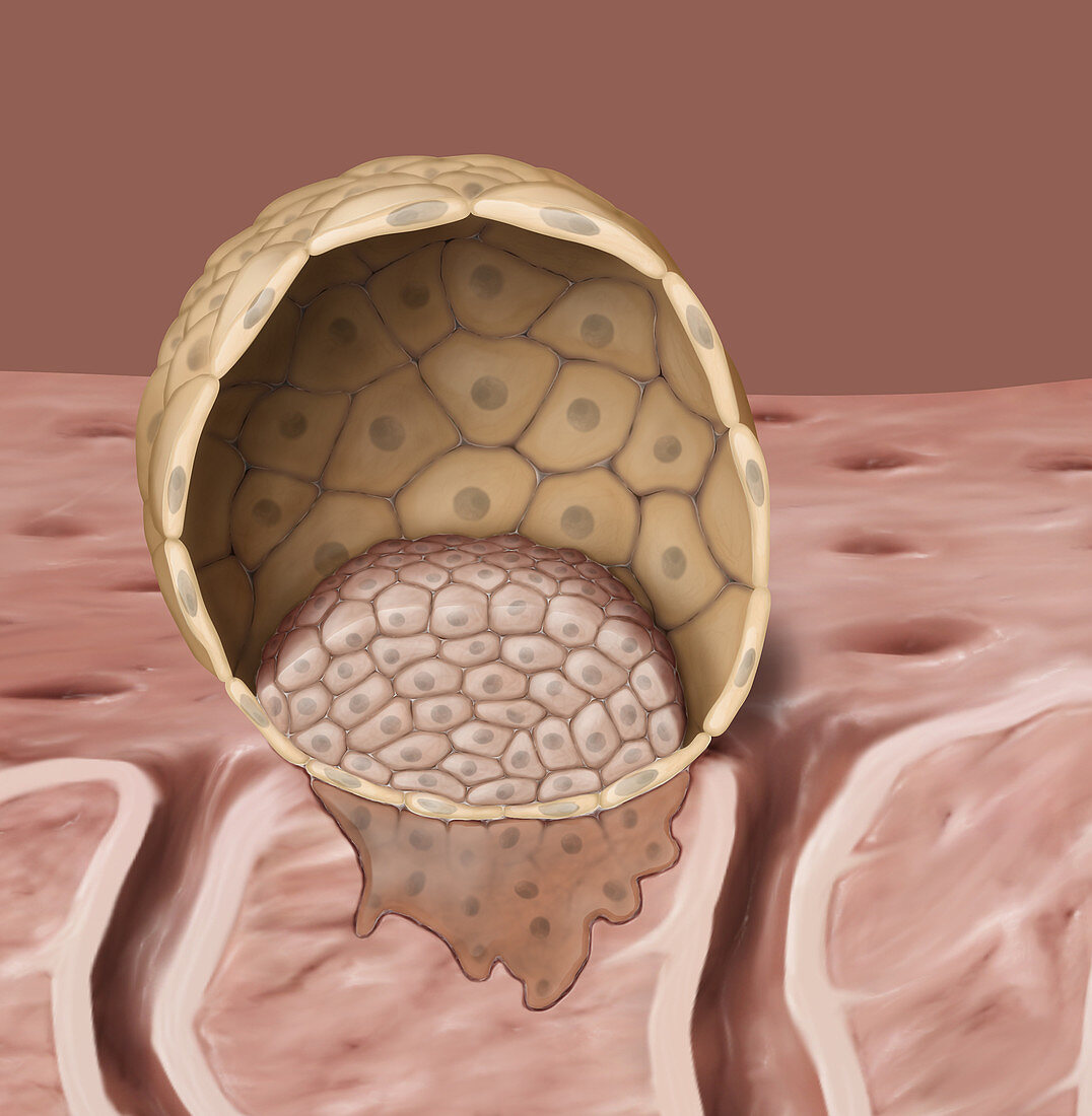 Blastocyst, illustration