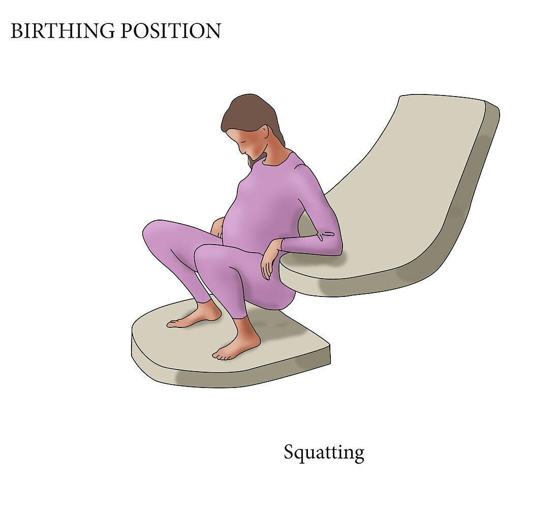 Squatting Birthing Position, illustration