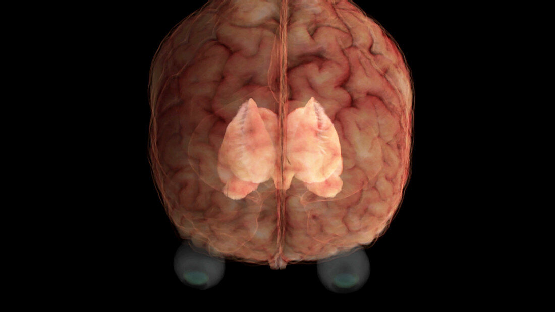 Brain, Caudate Nucleus and Lentiform Nucleus