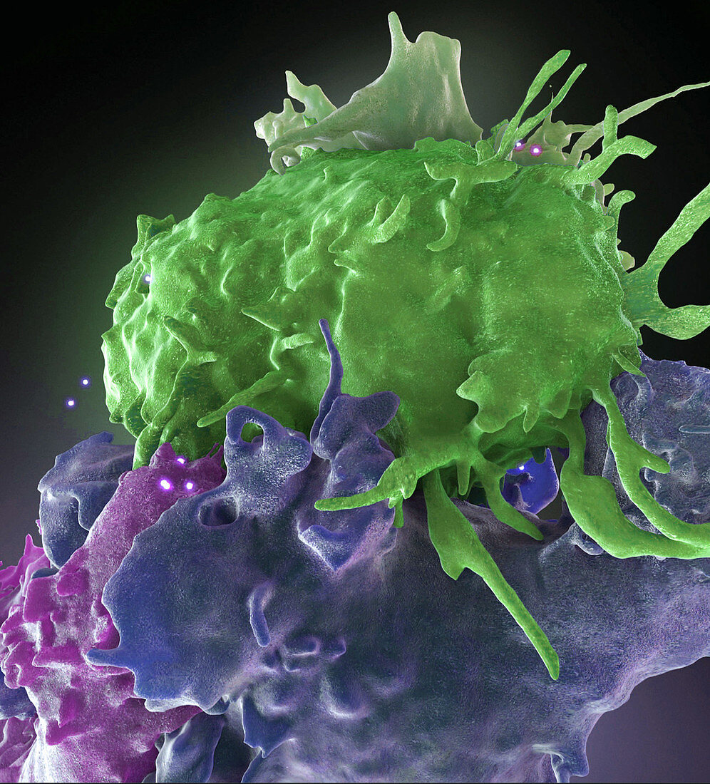 HIV-Infected and Normal T Cells Interact, FIB-SEM