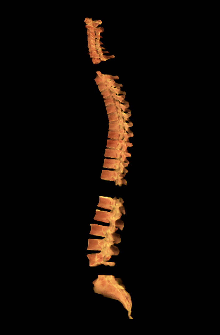 Spinal Column, Separated by Regions