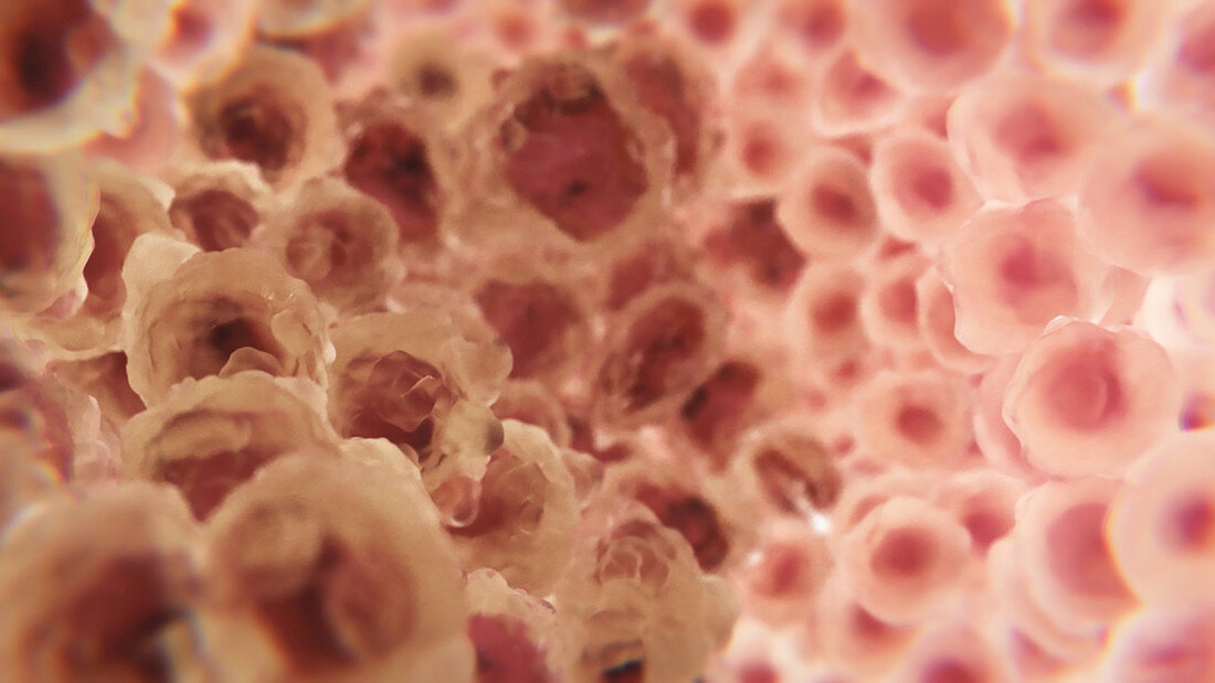 Cancer Cells Metastasizing Near Normal Cells