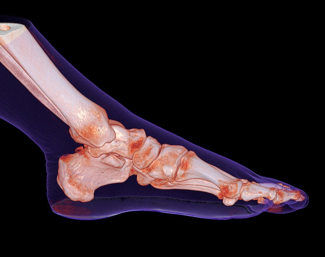 Human foot and ankle, 3D CT scan