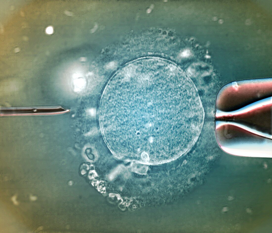 In vitro fertilisation, light micrograph