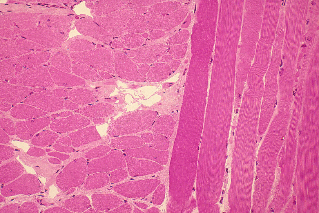 Striated Muscle, LM