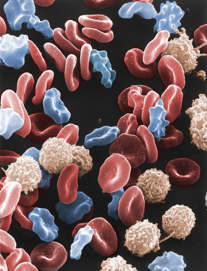 Red and White Blood Cells, SEM