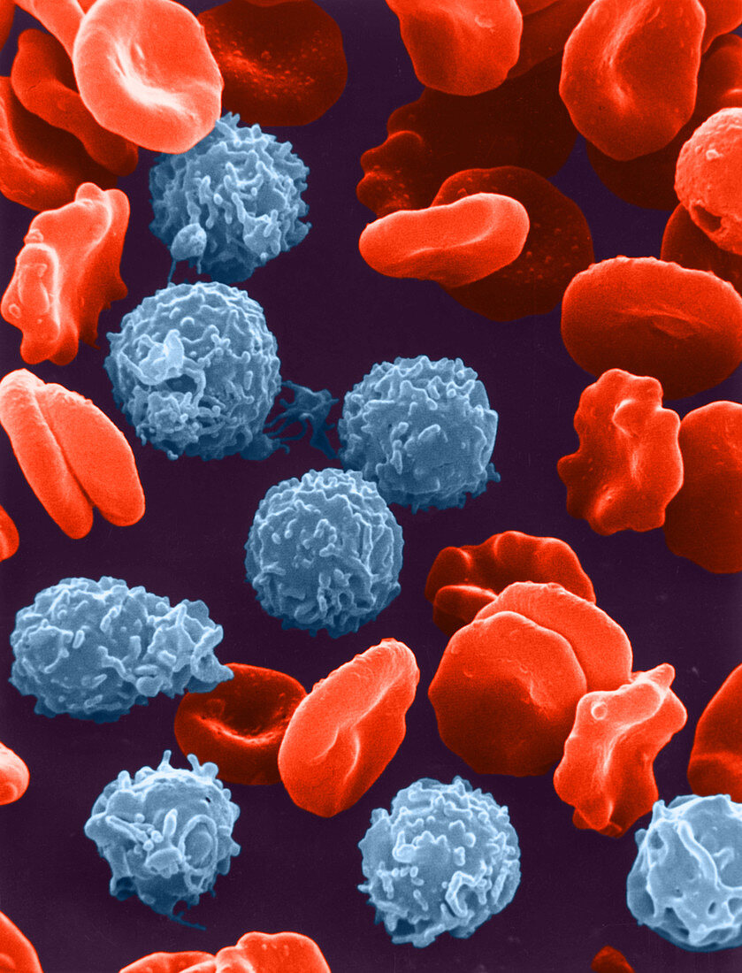 Red and White Blood Cells, SEM
