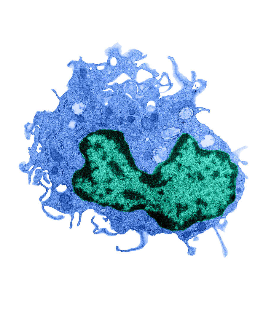 Dendritic Cell, TEM