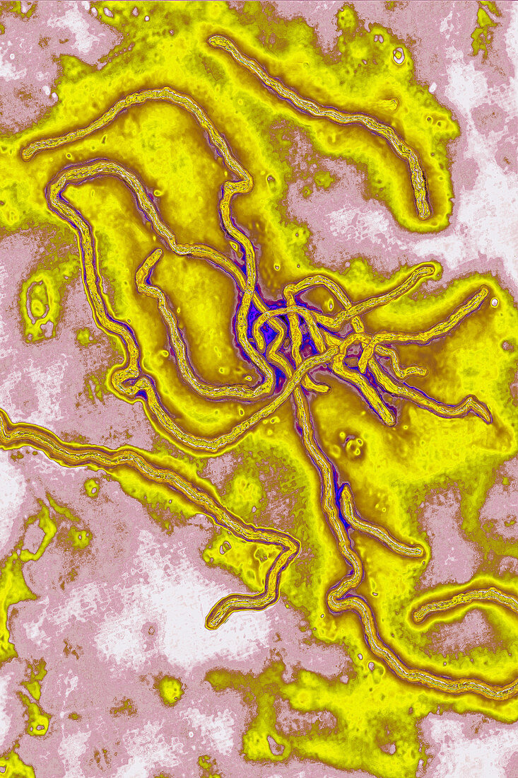 Ebola virus, TEM
