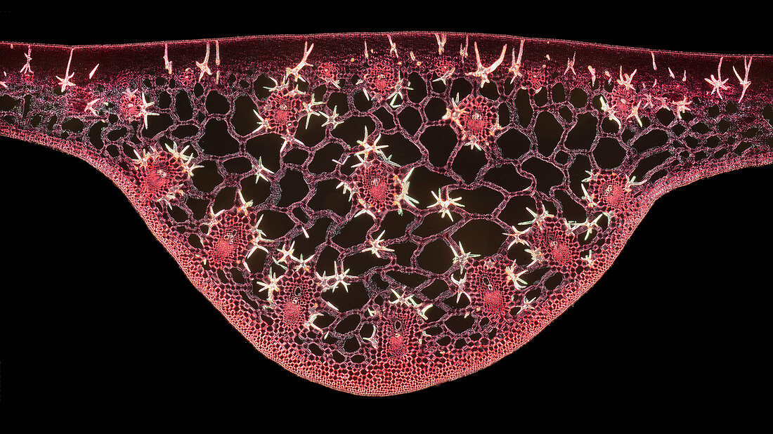 Idioblasts in water lily stem, polarised light micrograph