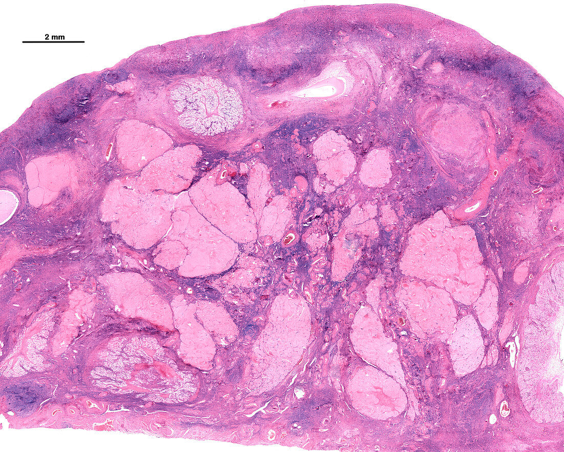 Menopausal ovary, light micrograph