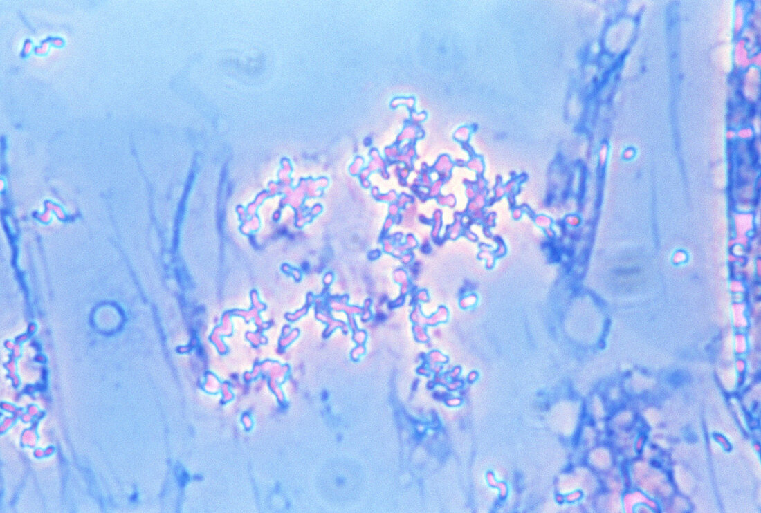 Thiobacillus thioparus, LM