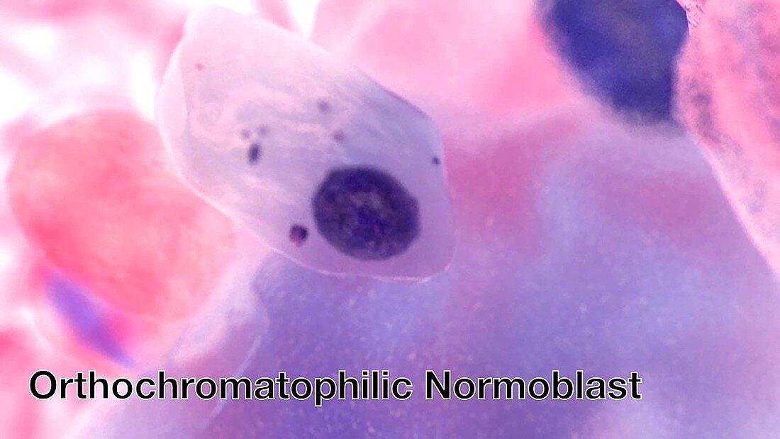 Orthochromatophilic Normoblast