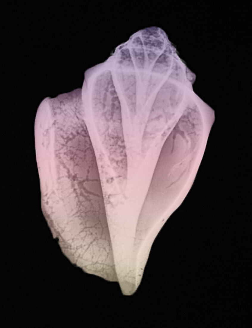 Conch Shell, X-ray