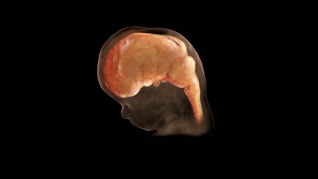 Prenatal Brain Development at 59 Days