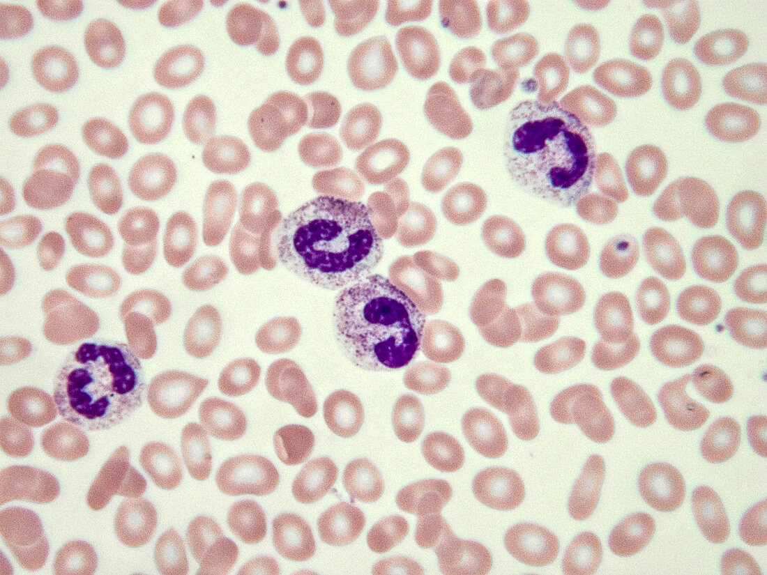 Banded Neutrophils, LM