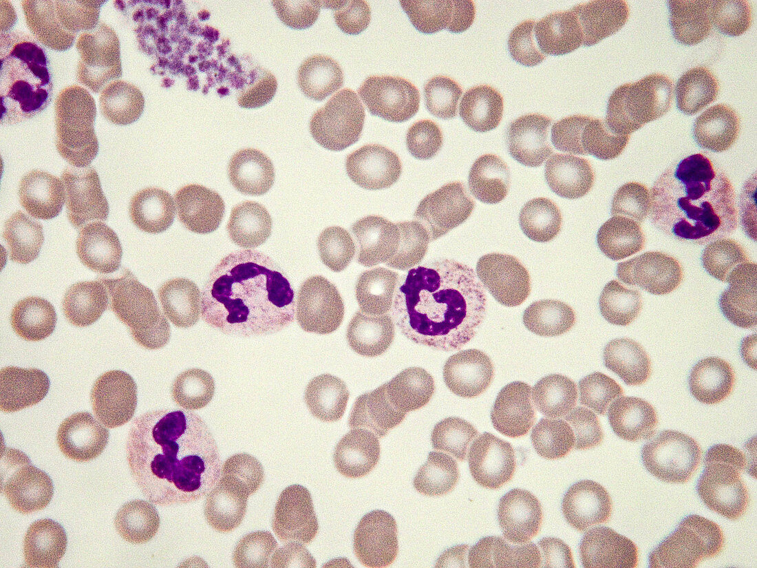 Banded Neutrophils, LM