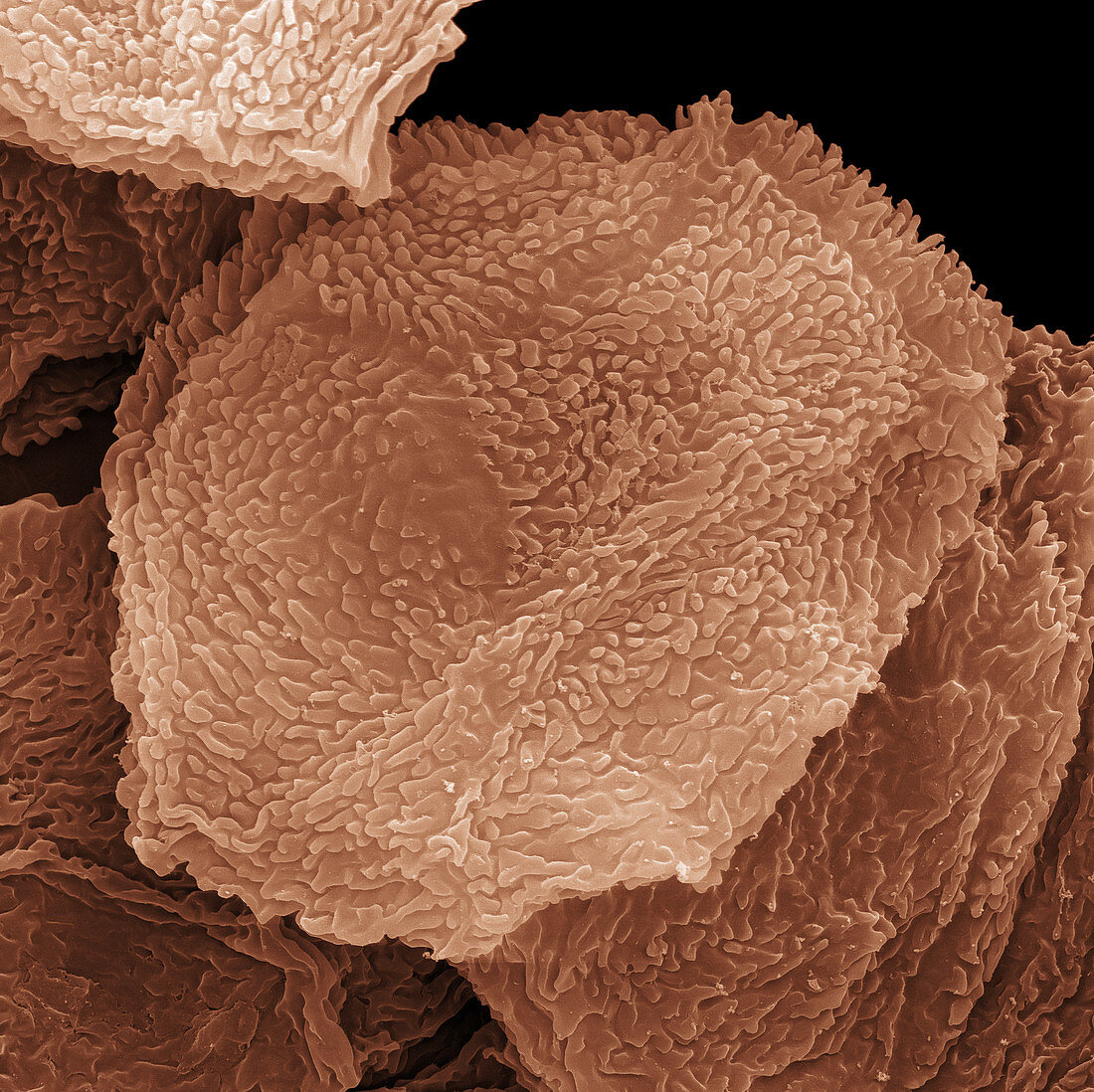 Human Foot Skin Cells, SEM