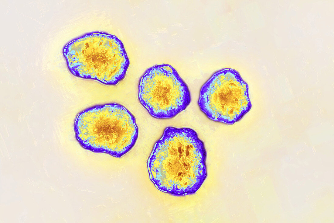 Measles Virus, TEM