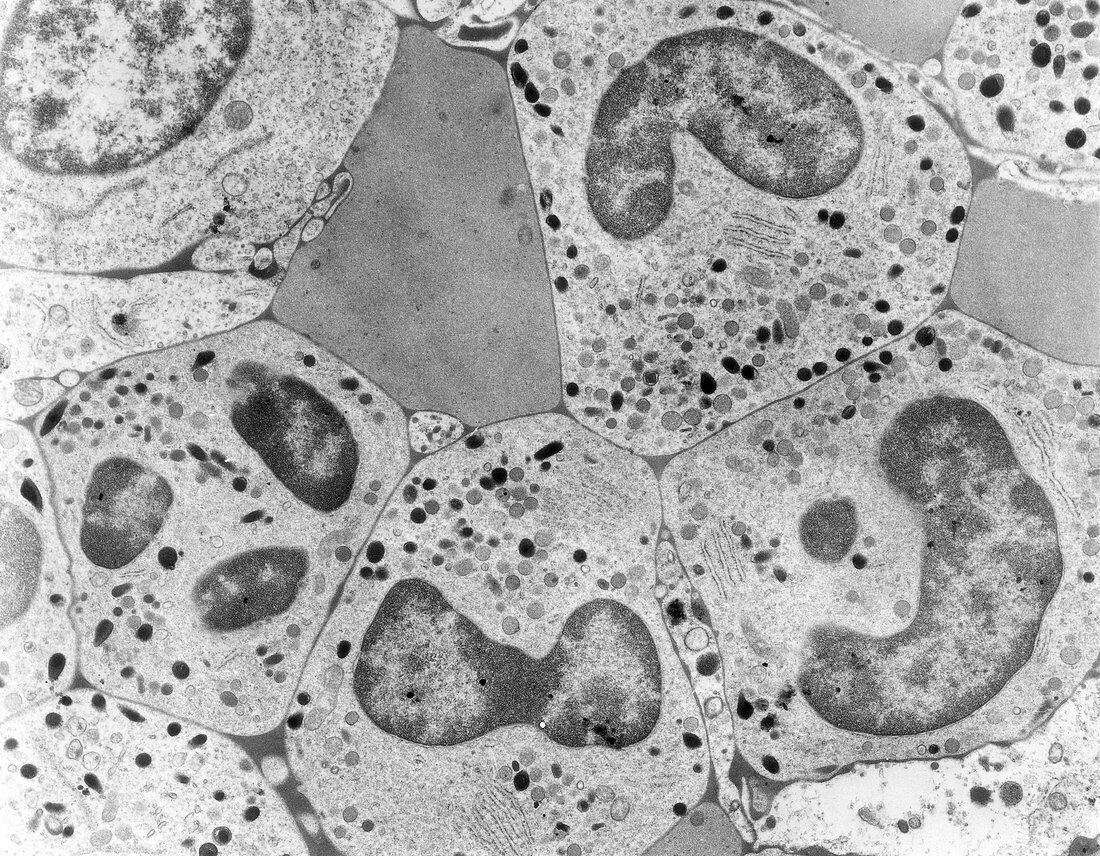 Neutrophilic Metamyelocytes, TEM