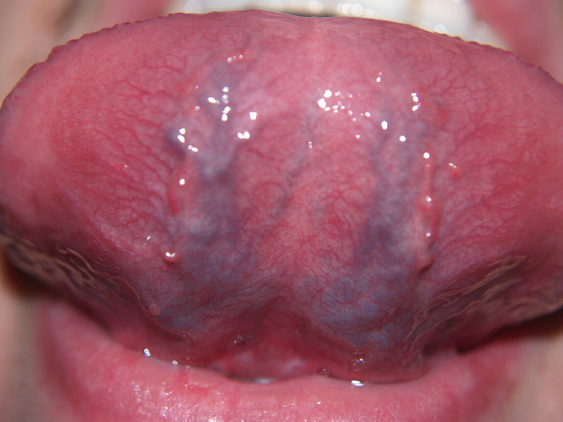 Underside of Tongue