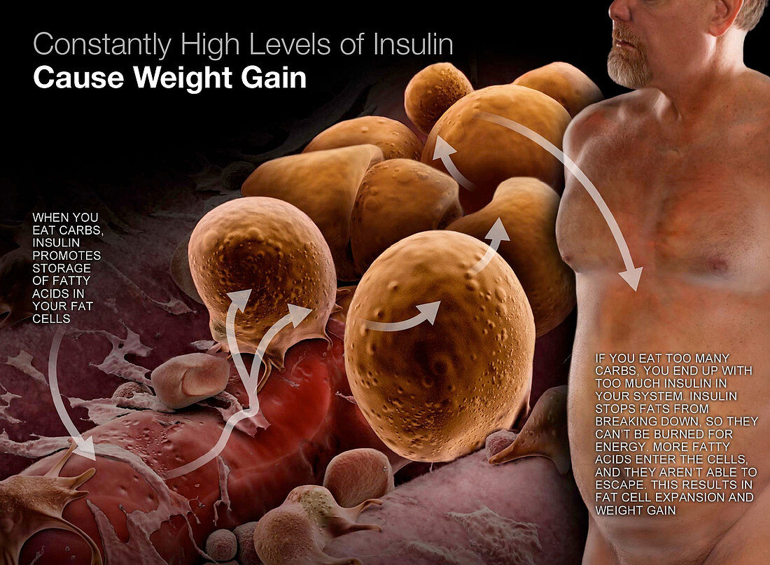 Insulin and Weight Gain