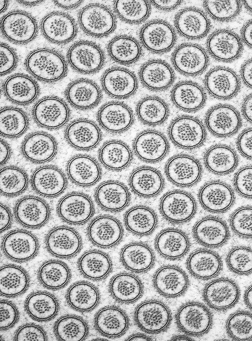 Microvilli on Intestinal Epithelial Cell, TEM