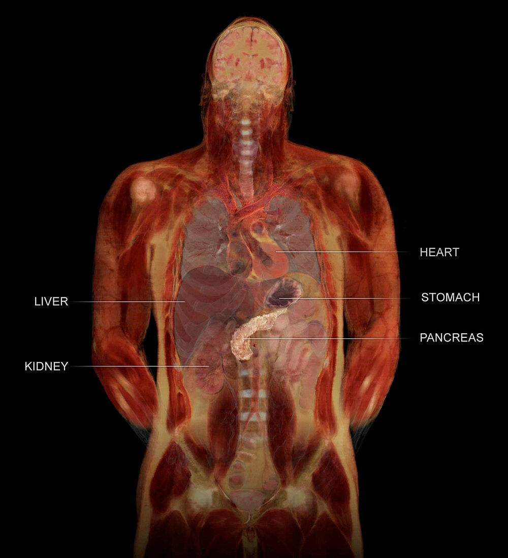 Coronal Section of Organs