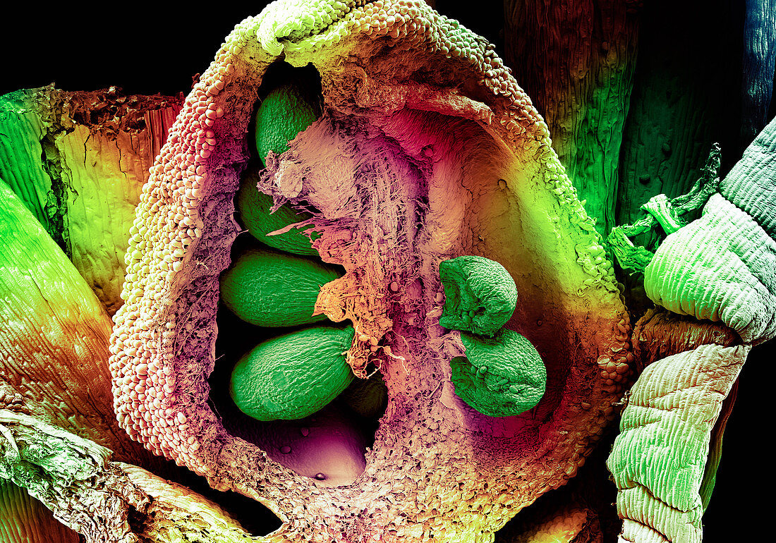 Ovule with Embryo Sac, SEM