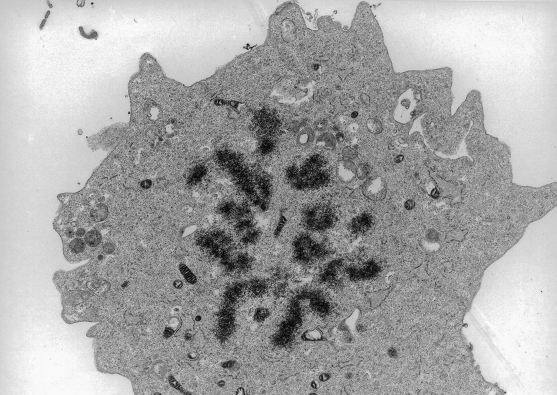 Islet cell mitosis, TEM
