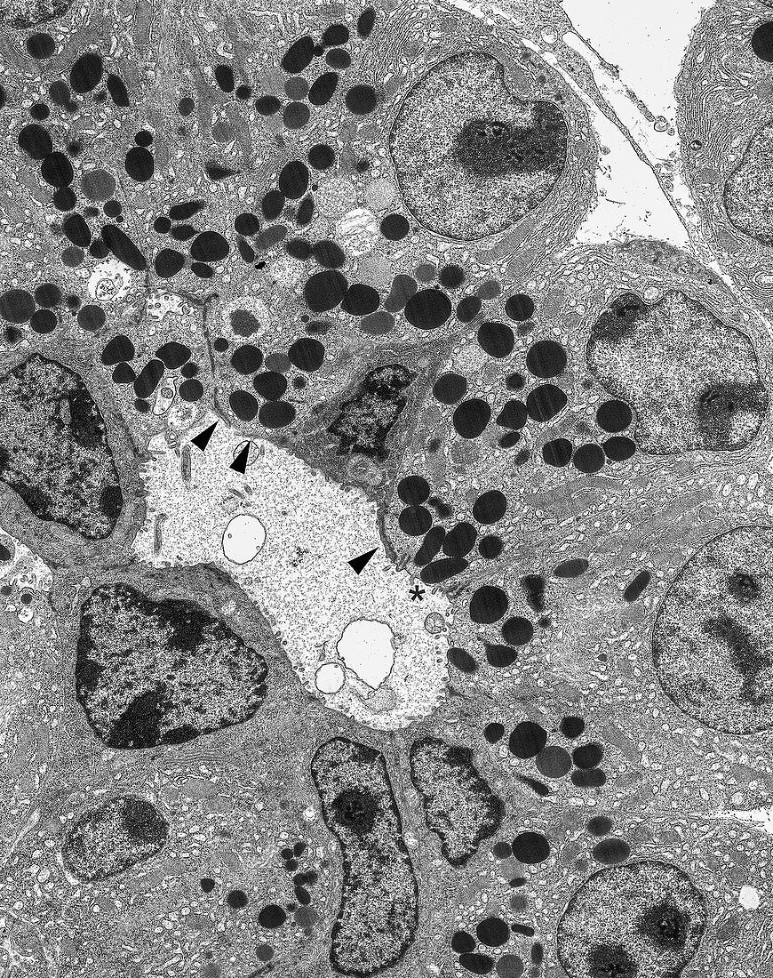 Pancreatic Acinar and Centroacinar cells, TEM