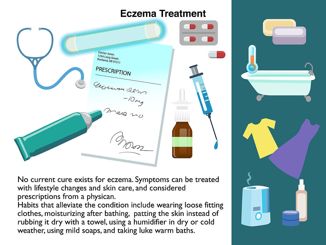 Eczema treatment, infographic