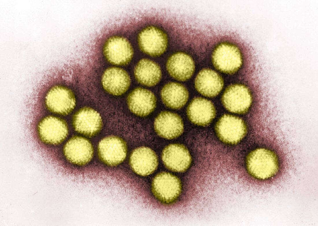 Adenovirus, TEM