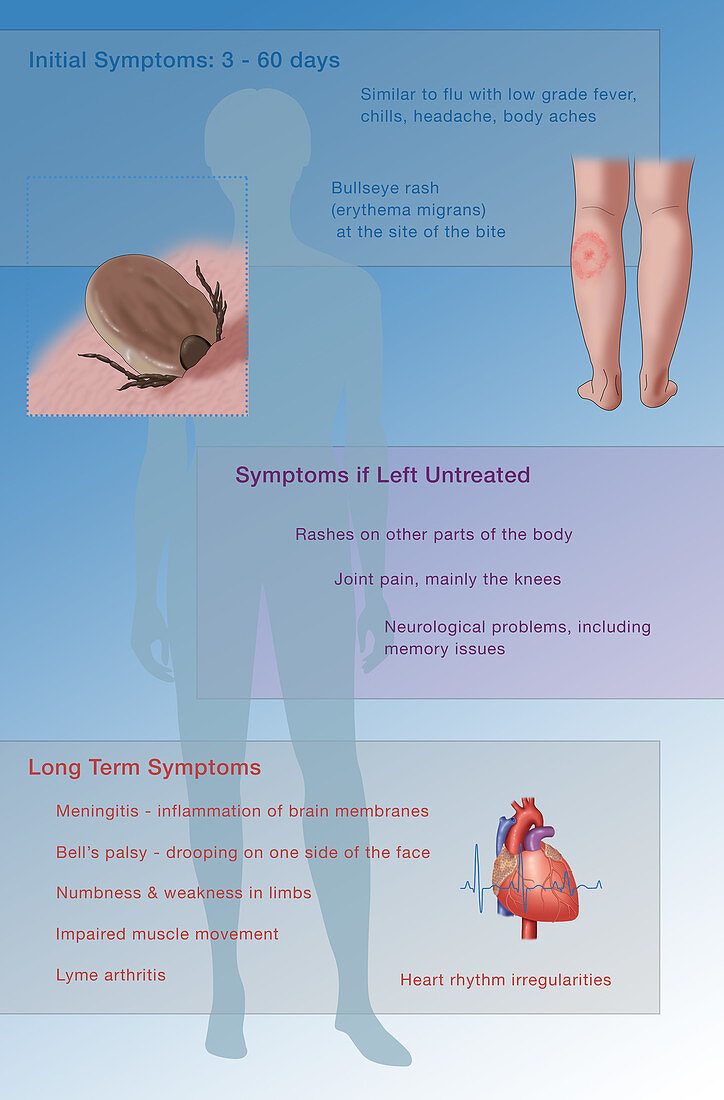 Symptoms of Lyme Disease, Illustration