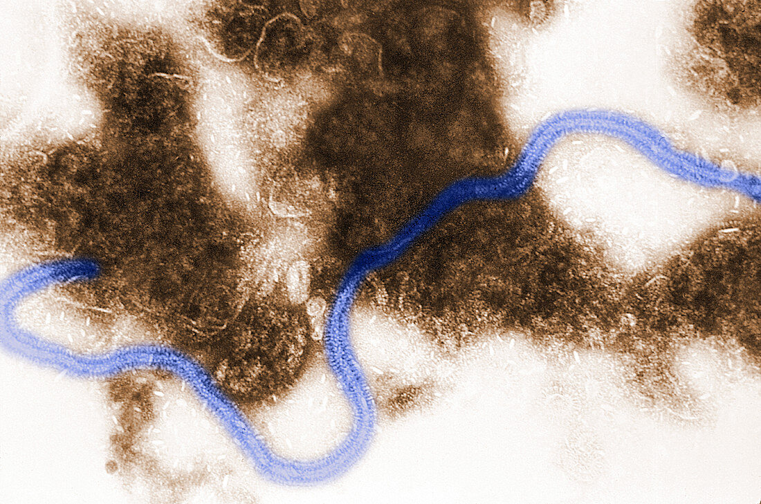 Human Respiratory Syncytial Virus, TEM