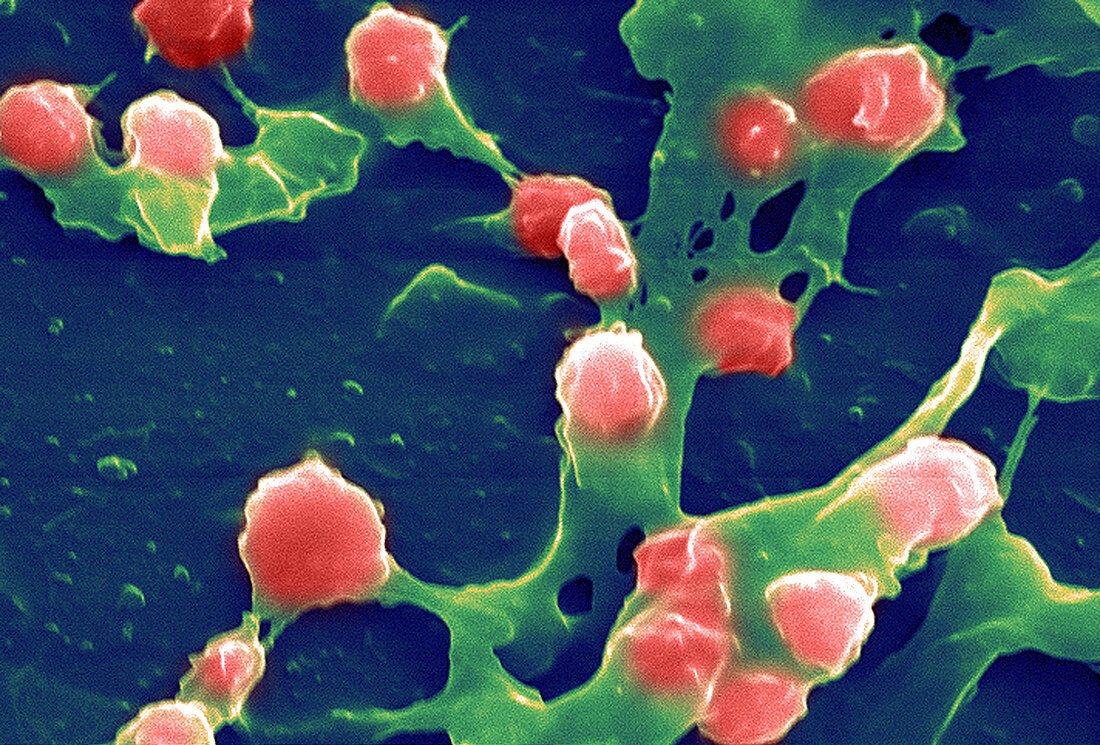Staphylococcus aureus Bacteria, SEM
