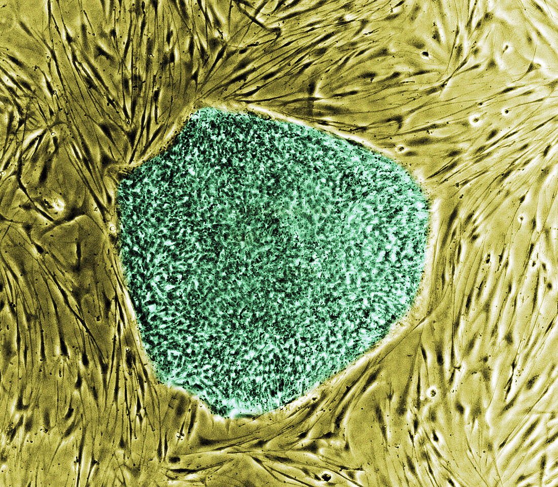 Human Embryonic Stem Cell Colony, LM