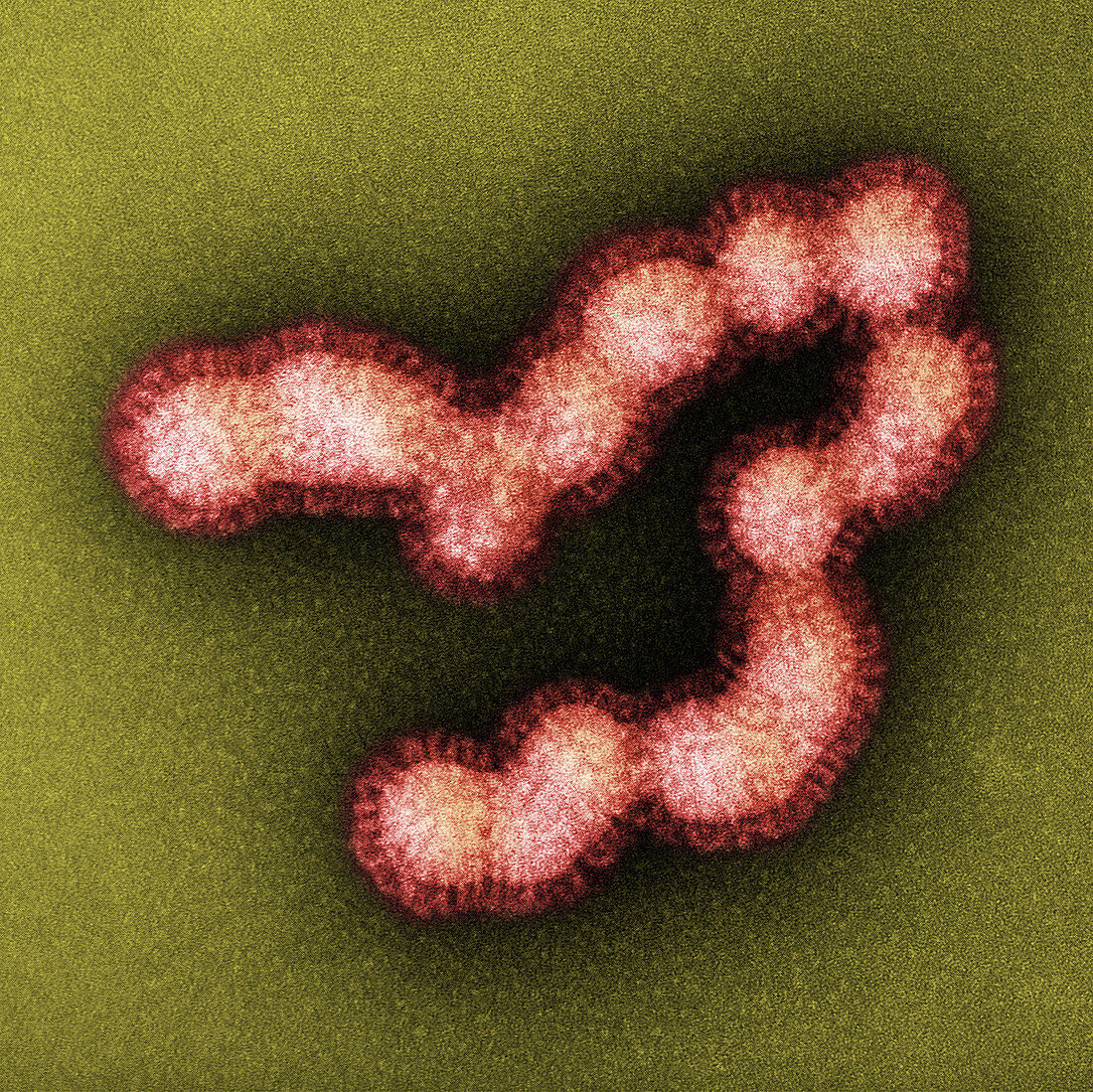 SW31, Swine Flu Strain Virus, TEM