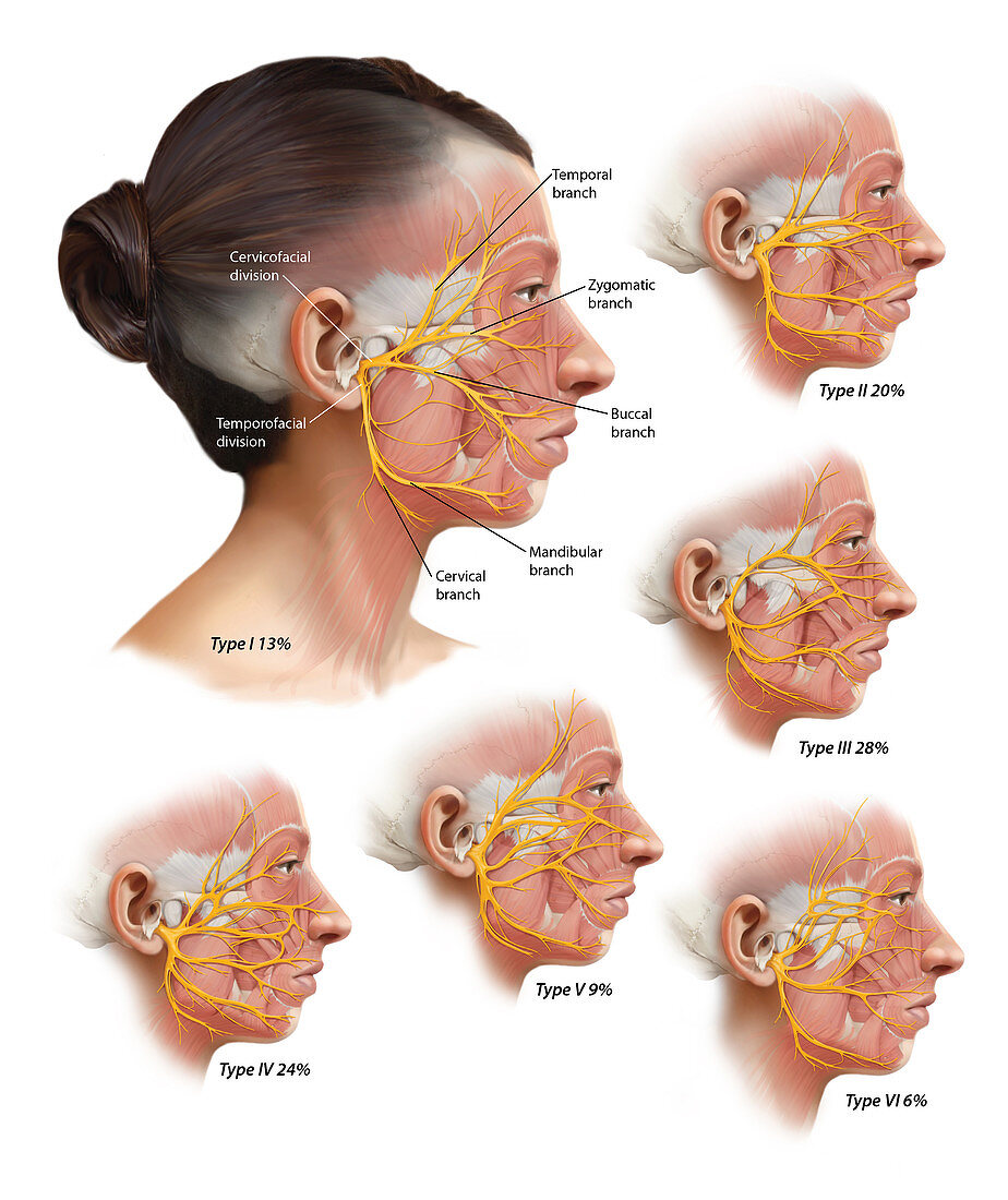 Facial Nerve