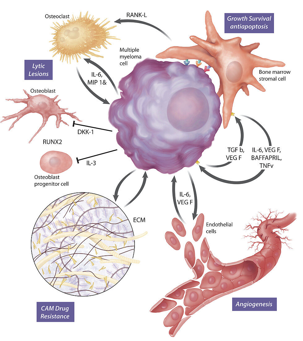 Multiple Myeloma in the bone marrow microenvironment