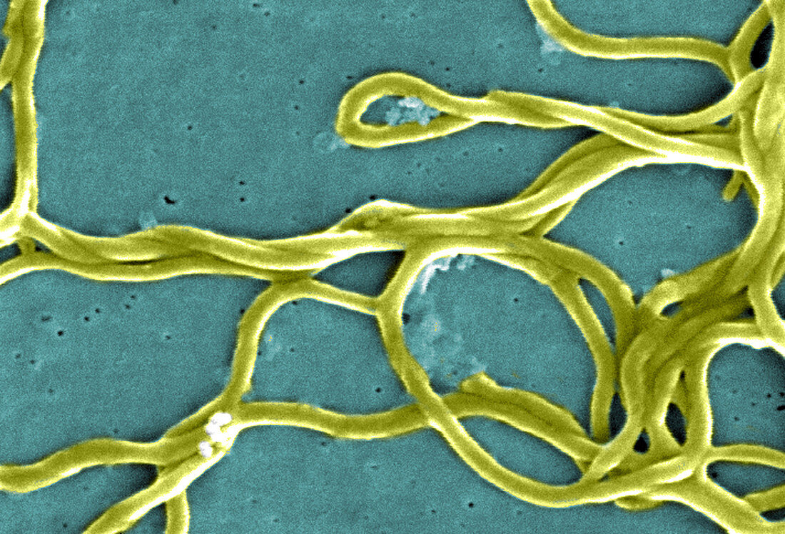 Lyme Disease, Borrelia burgdorferi Bacteria, SEM