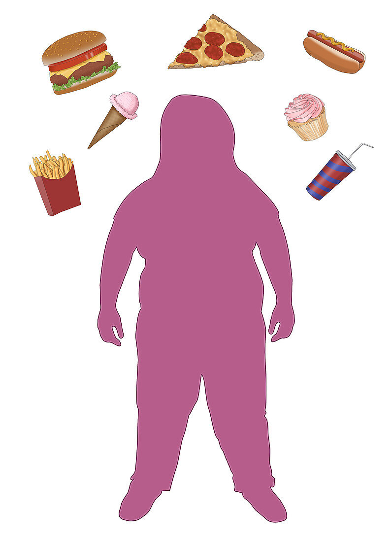 Obese Child and Junk Food, Illustration