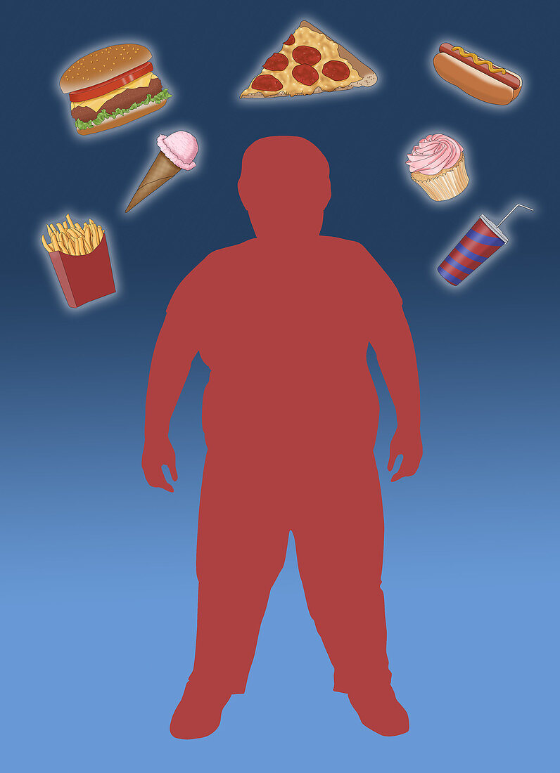 Obese Child and Junk Food, Illustration