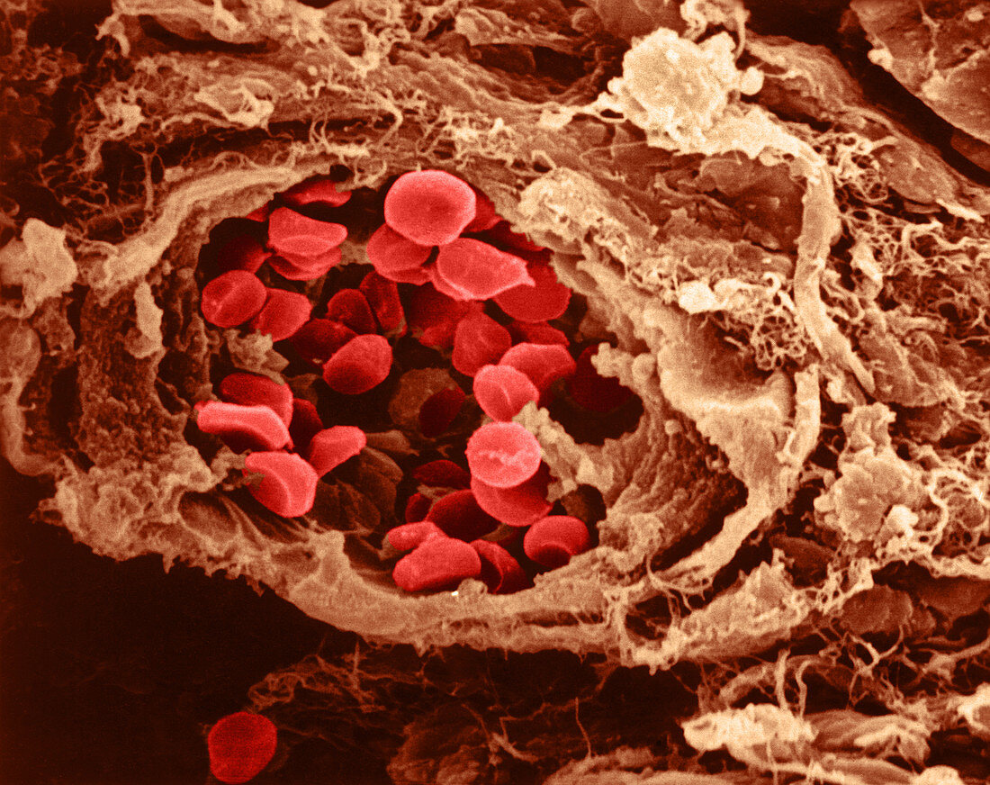 Red Blood Cells, Collagen Fibers, SEM