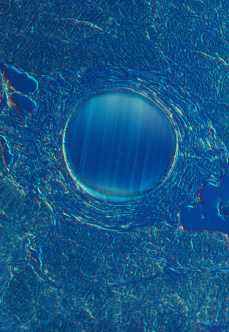 Skin Cross Section of Surgical Suture