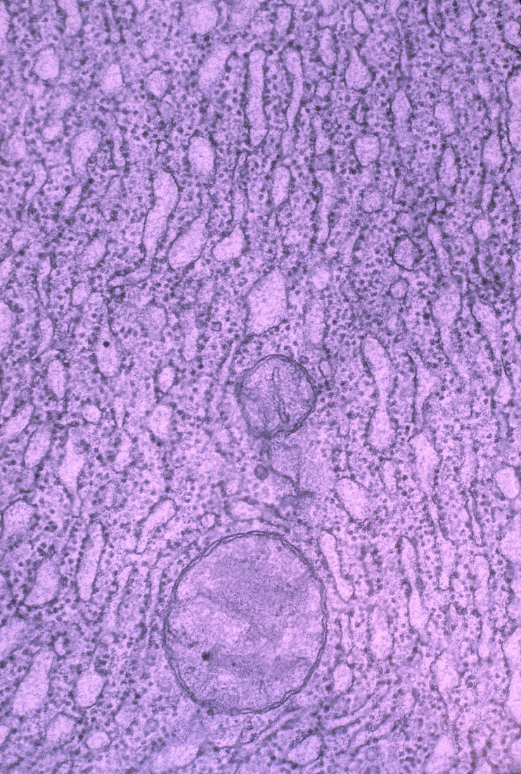 Endoplasmic Reticulum with Ribosomes