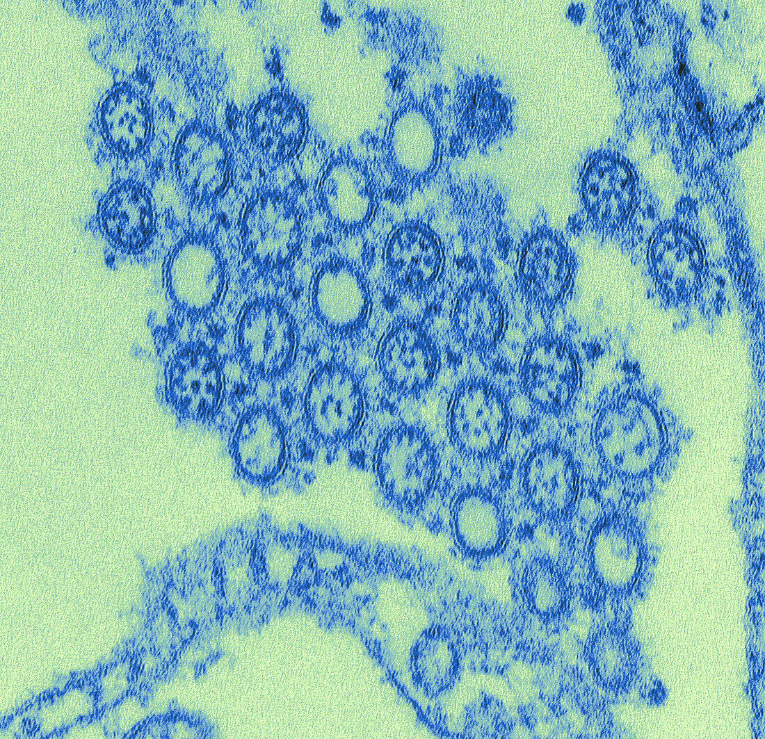 Novel Flu H1N1 Virus, TEM