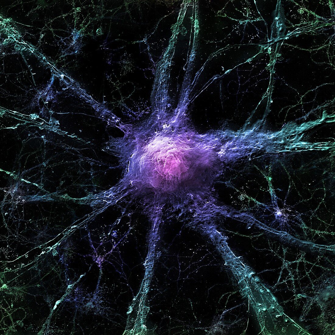 Healthy Neuron, SEM