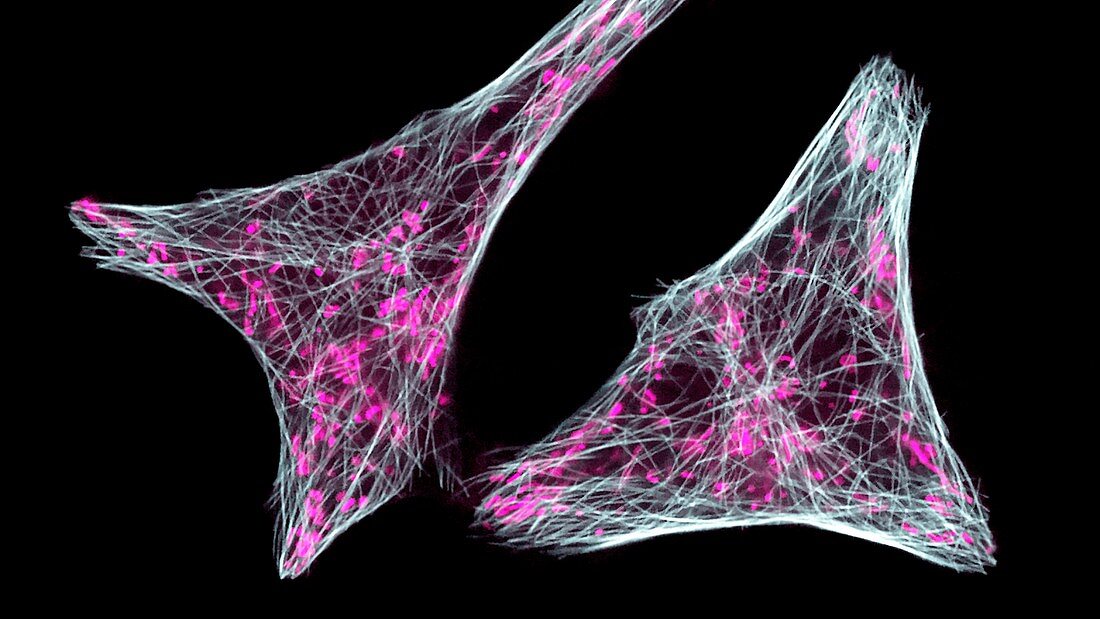 Mitochondria in breast cancer cells, fluorescent micrograph